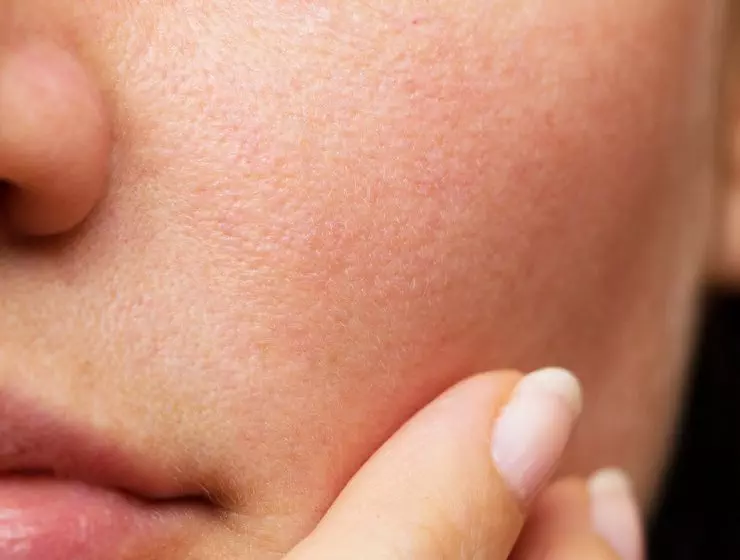 Close-up image of a person's cheek showing details of skin texture and pores, with a hand gently pressing on the cheek.